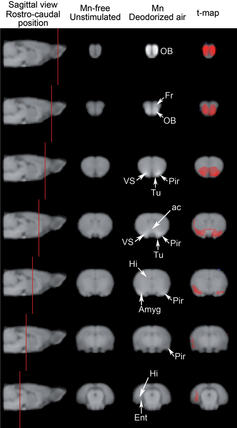 Images fonctionnelles d'un cerveau de rat en plusieurs coupes